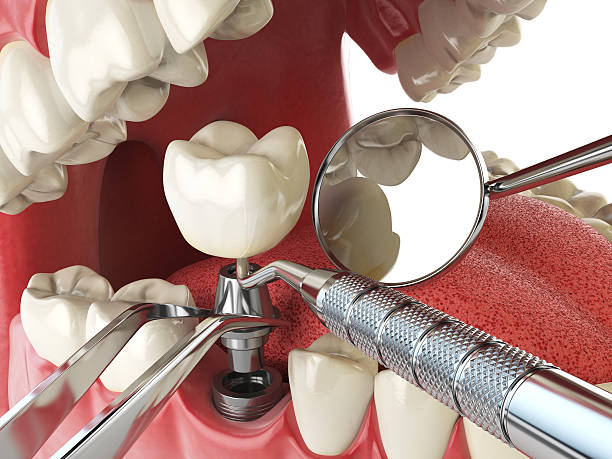 Best Emergency Orthodontic Repairs in Mannford, OK